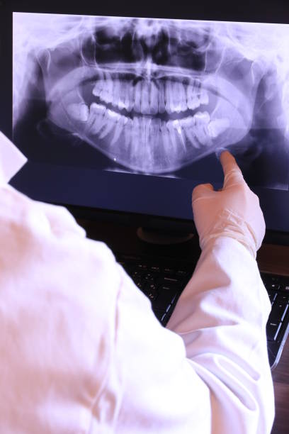 Best Emergency Dental Extractions in Shokan, NY